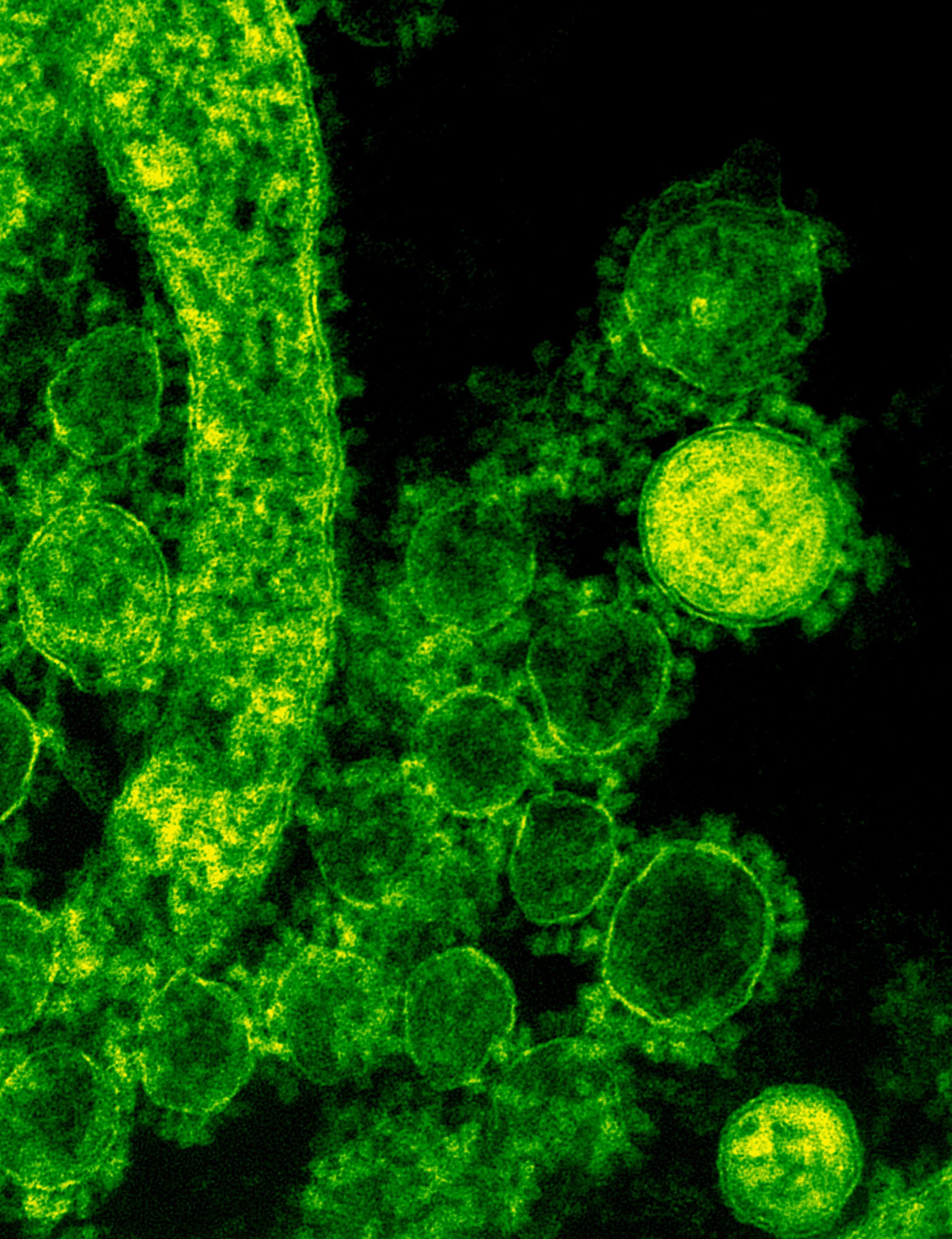 Congo Ebola Outbreak Becomes Fastest Ever to Surpass 1,000 Deaths