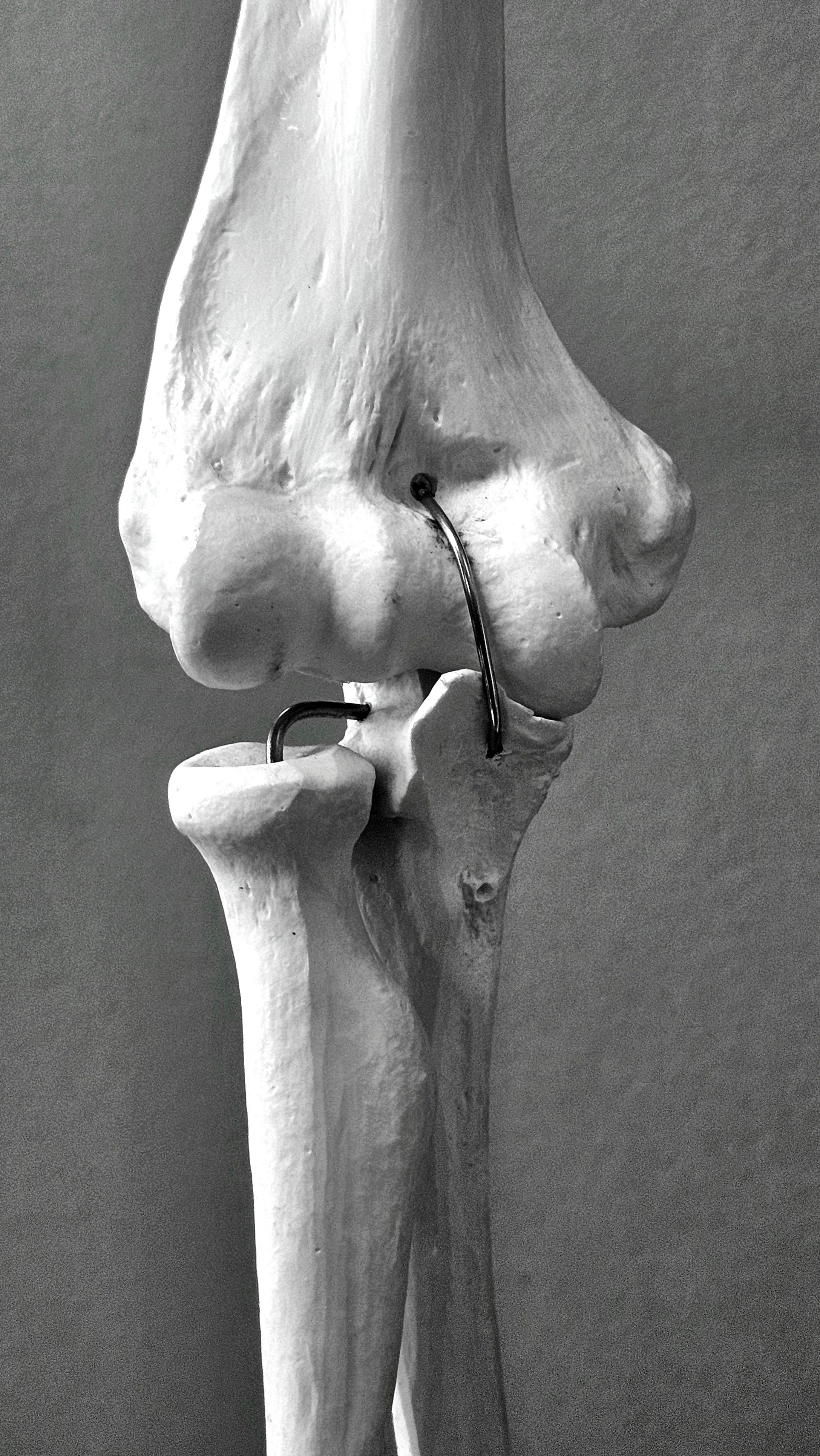 Bone Health: Best Foods to Eat for Strong Bones and Osteoporosis Prevention